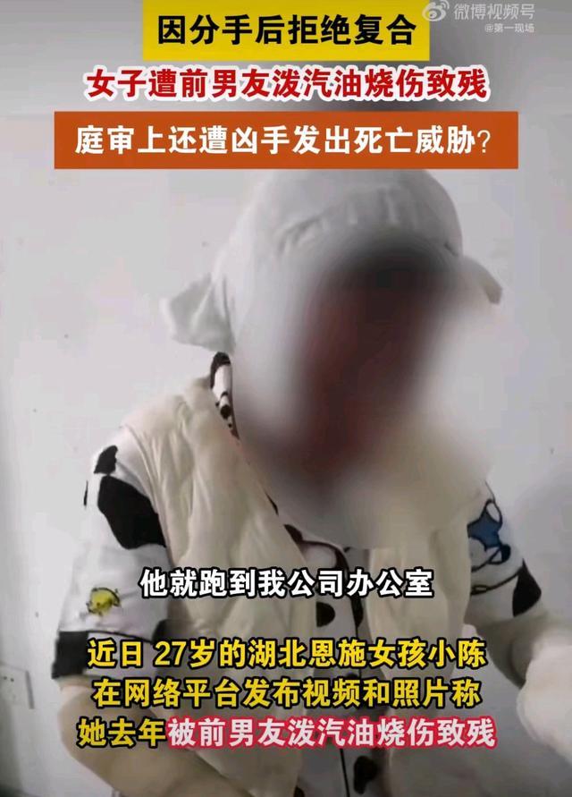 27岁女子被烧伤庭审遭前男友死亡威胁 极端暴力引公愤  第1张